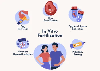 Stages of IVF