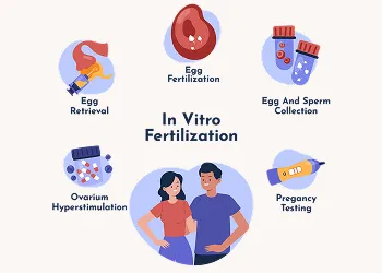 IVF Cycle Length