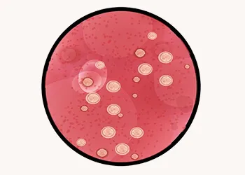 Yeast Infection