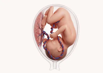 What Is a Gestational Sac?